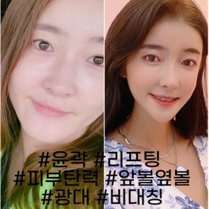 피부관리권 핀매합니다