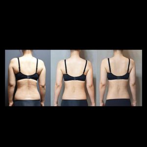 등관리 / 군살케어 / 산후 다이어트 / 피부관리 받으세요👙