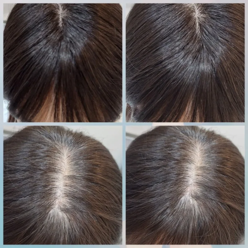 인모부분가발 새가발 중고보다 더착해요