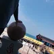 치루