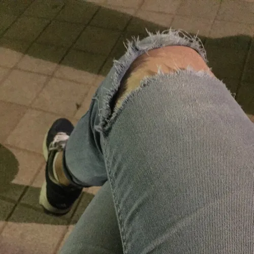 외팔이소년