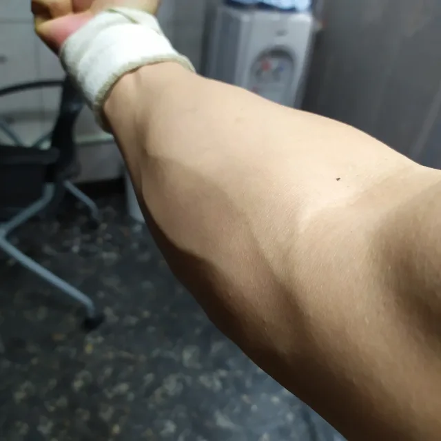 린희아비