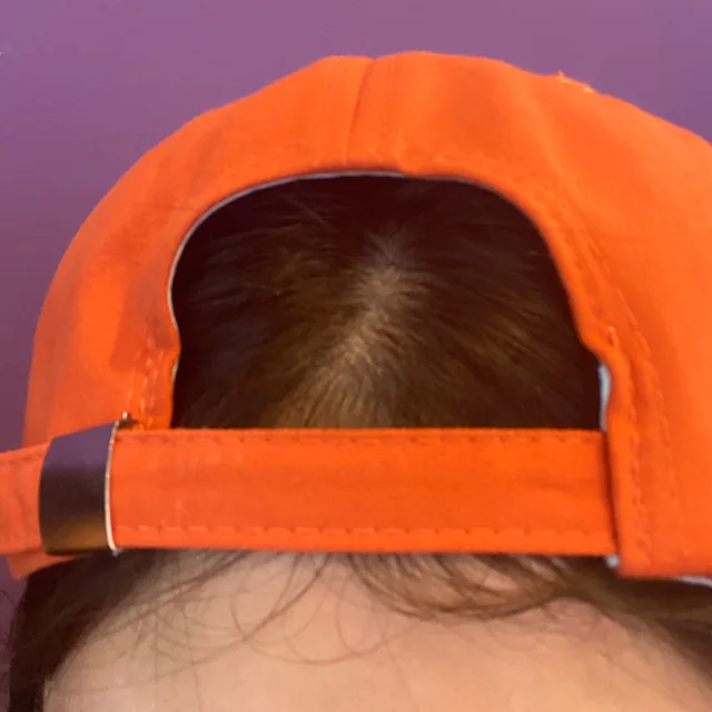 소소한알밤