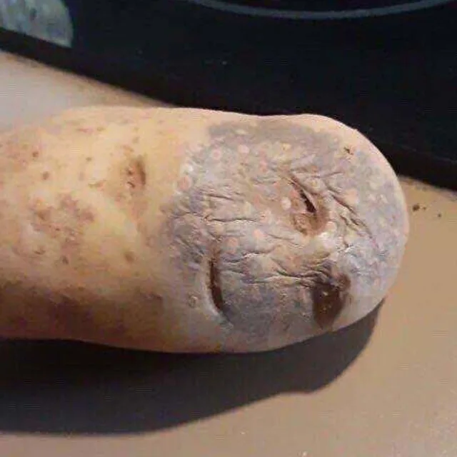 비소