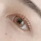 횽잉