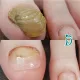 닥터아이티엔깔롱손톱