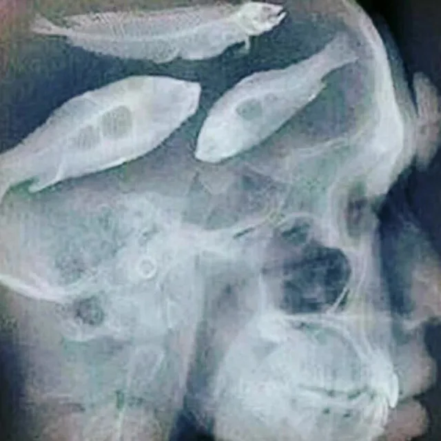 SIGMOID