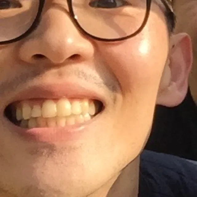 선희Park