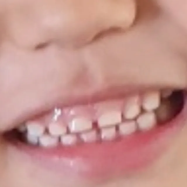 LEE