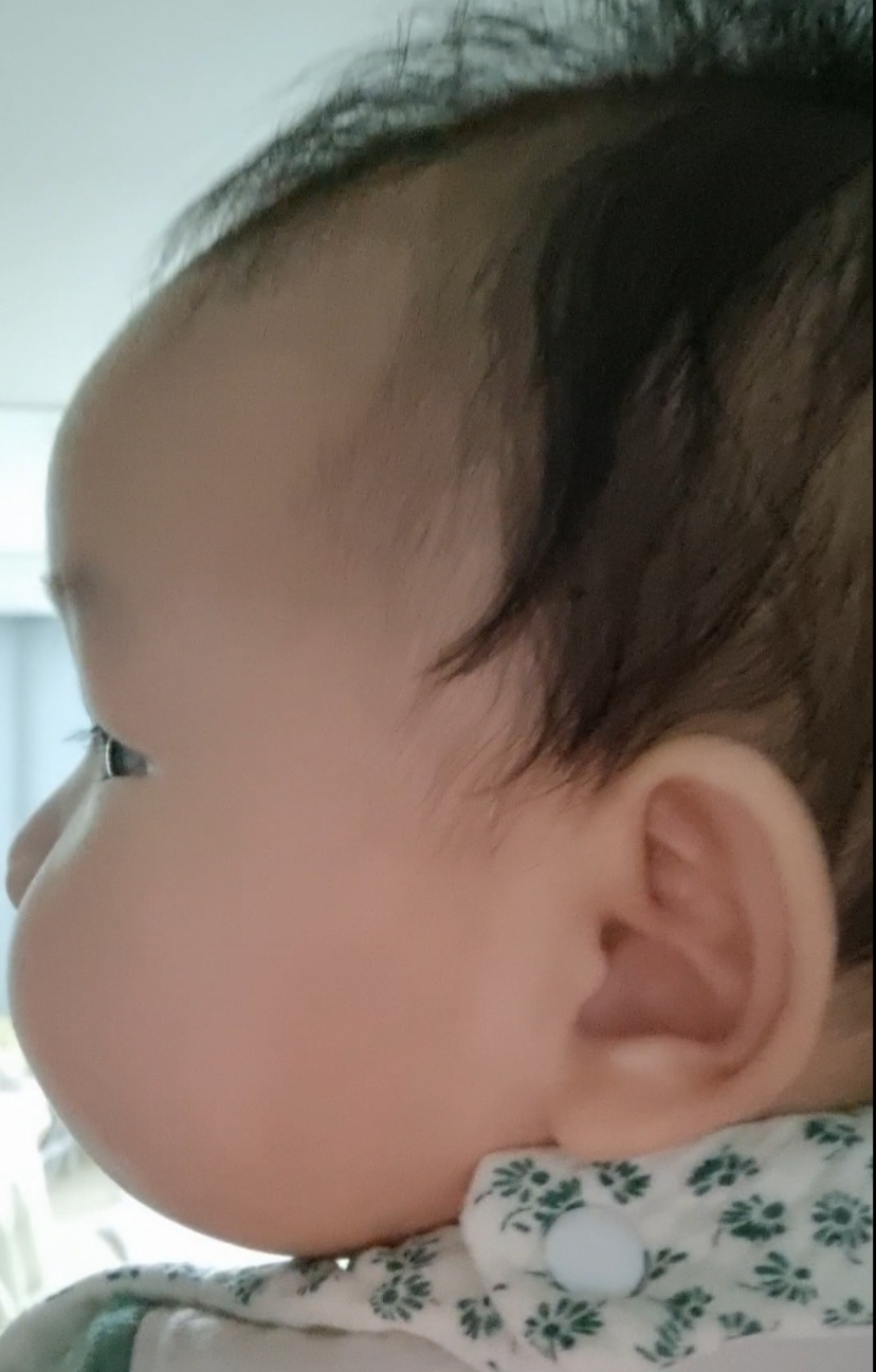 전백설