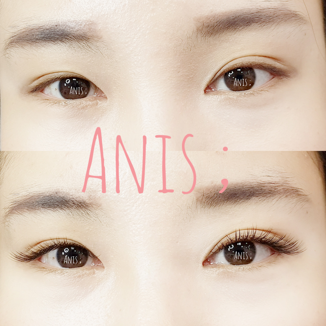 아니스 속눈썹