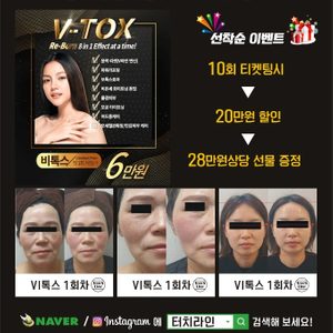 터치라인