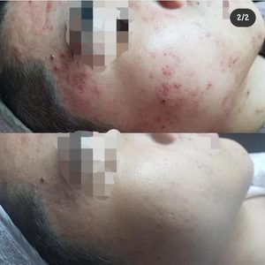 김승현스킨케어